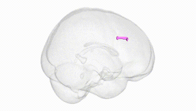 Full Brain White