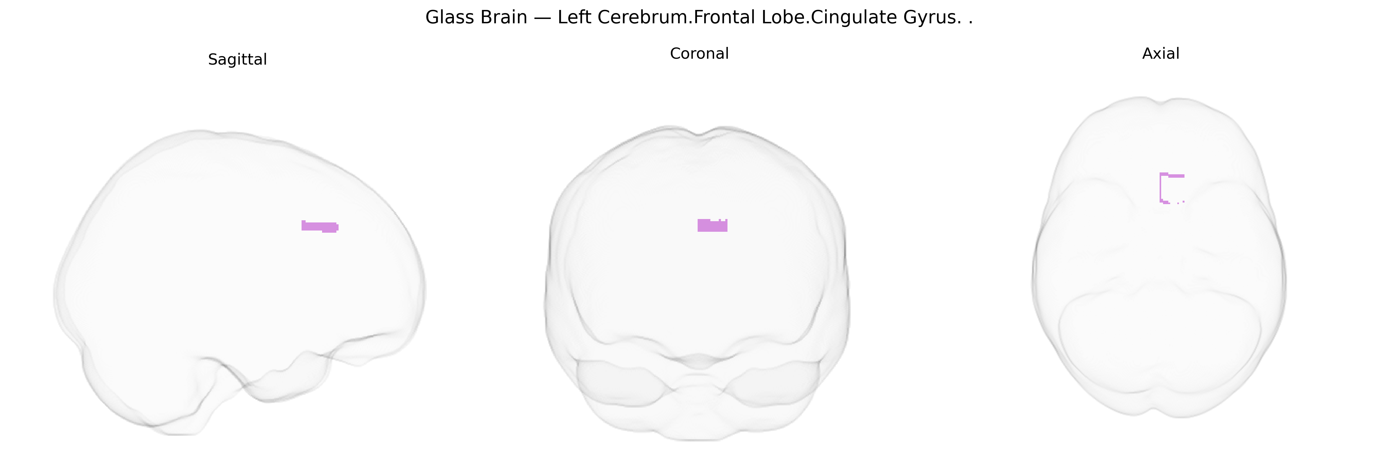 Triplanar Ghost Brain