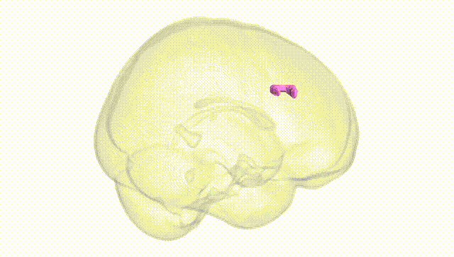 Full Brain White