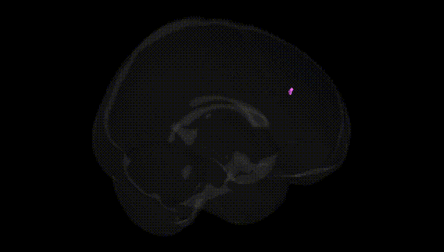 Full Brain Black