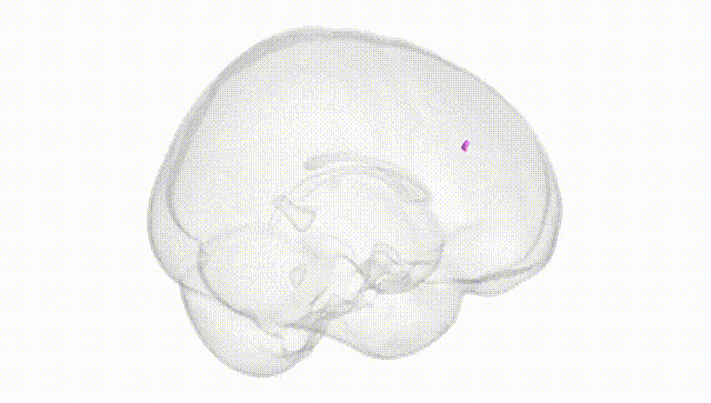 Full Brain White