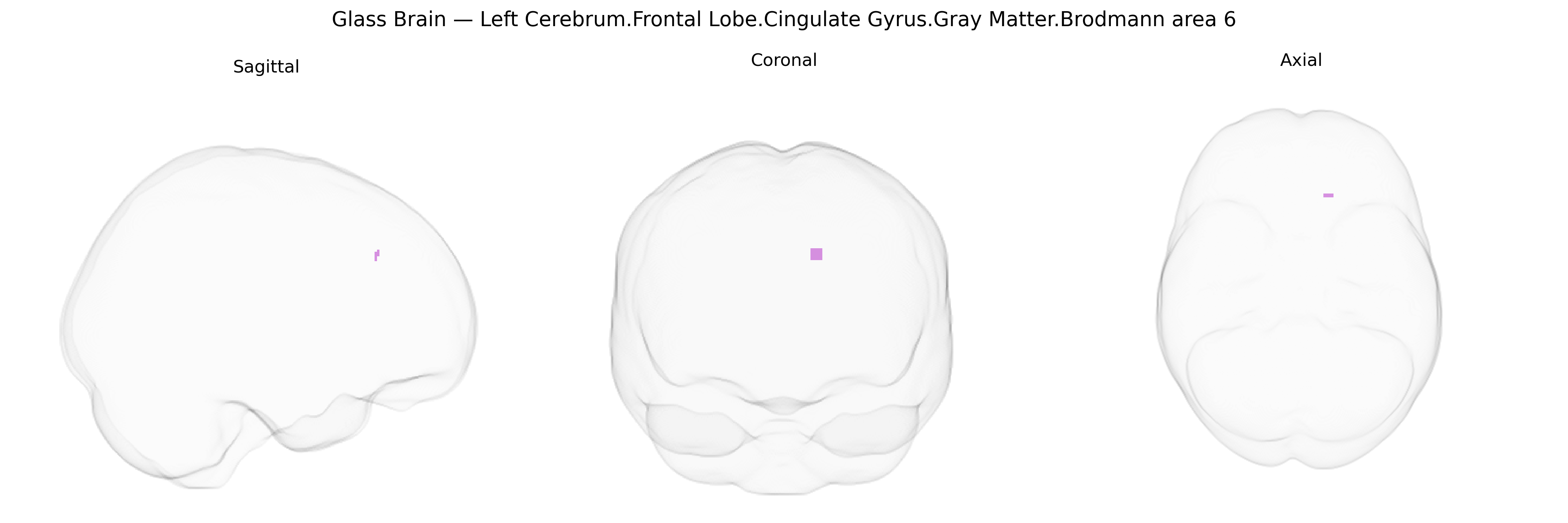 Triplanar Ghost Brain