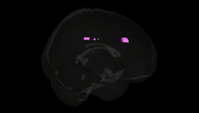 Full Brain Black