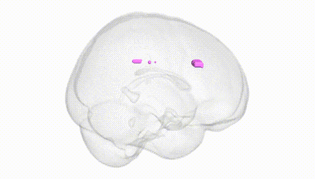Full Brain White