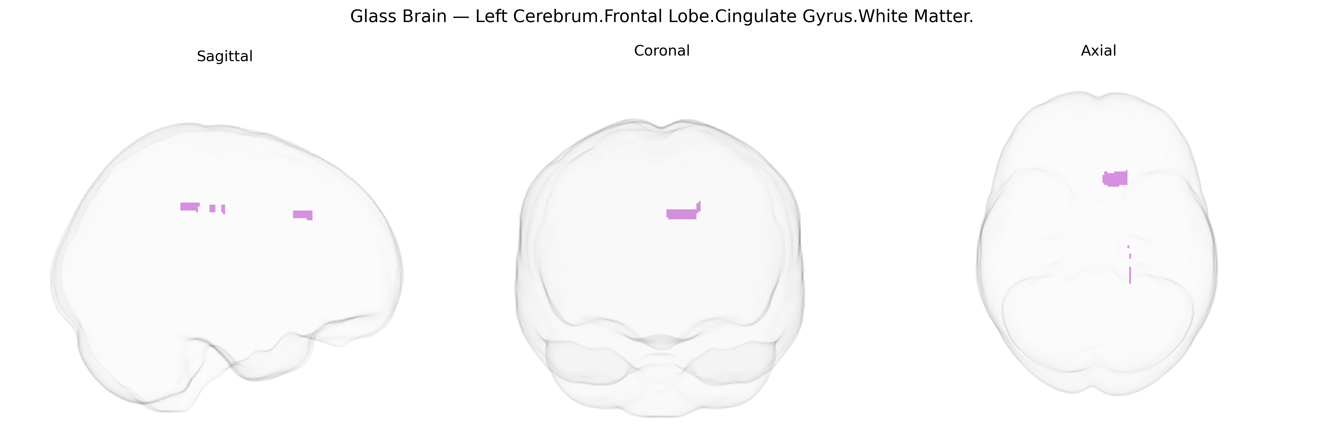 Triplanar Ghost Brain