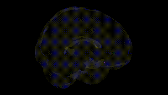 Full Brain Black