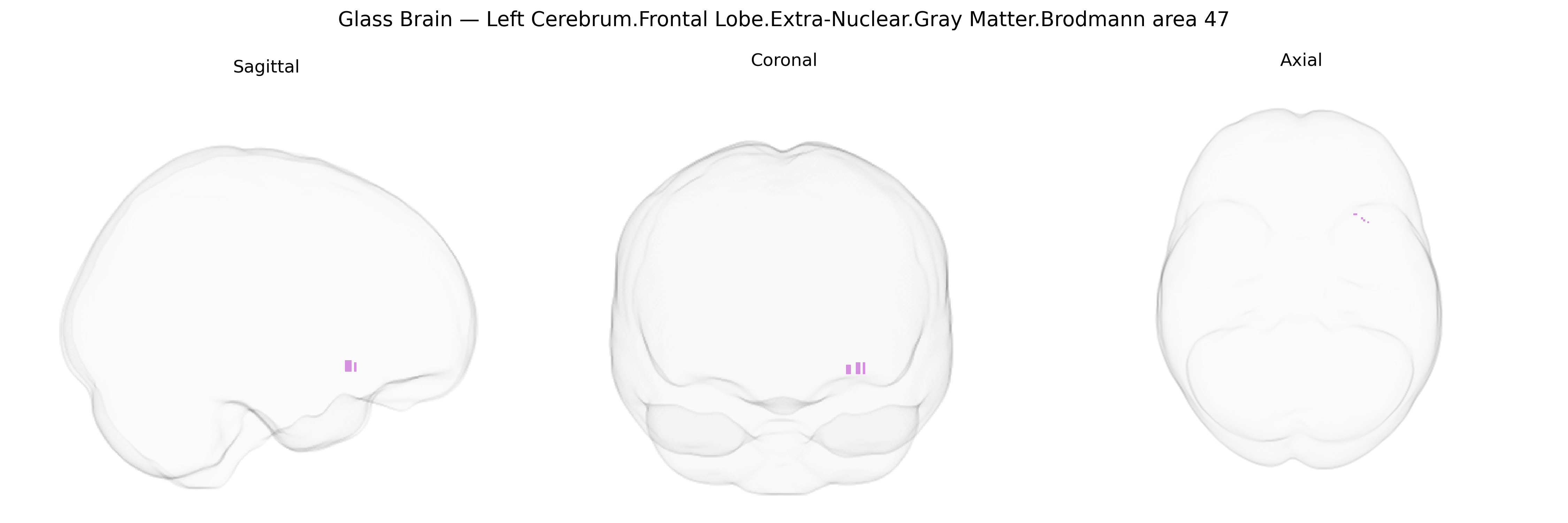 Triplanar Ghost Brain