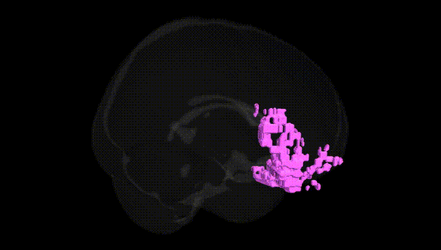Full Brain Black