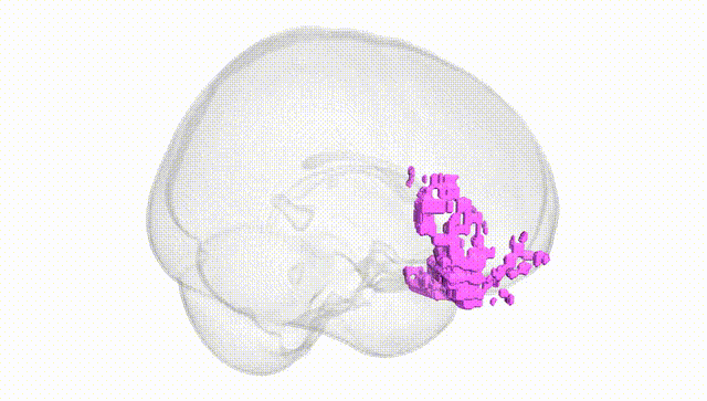 Full Brain White