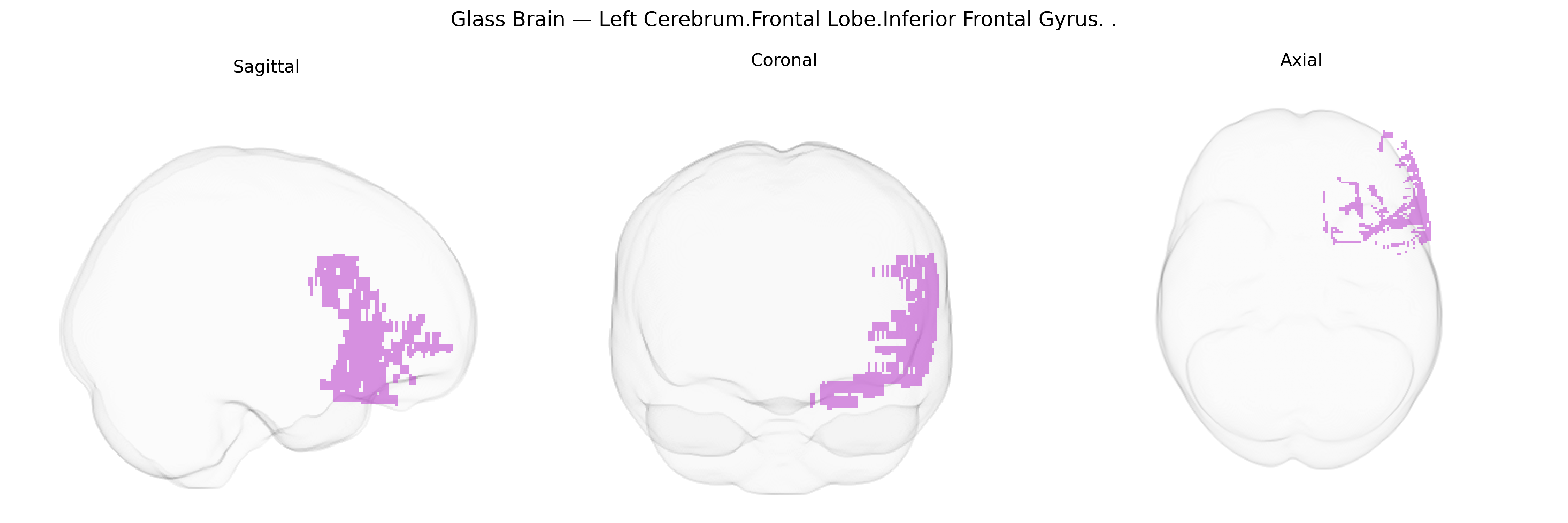 Triplanar Ghost Brain