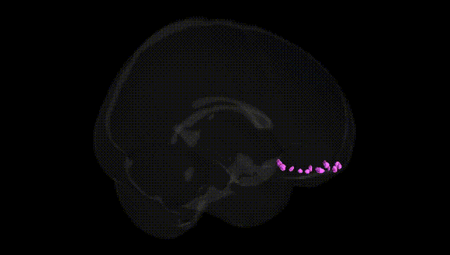Full Brain Black