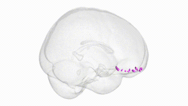 Full Brain White