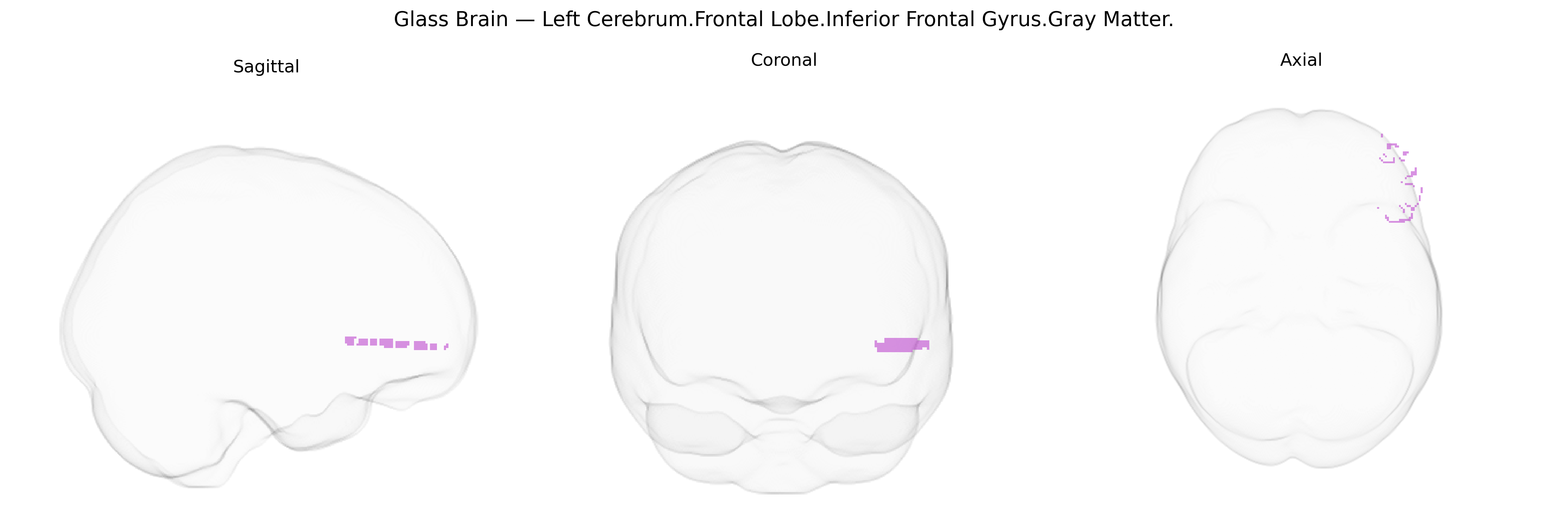 Triplanar Ghost Brain