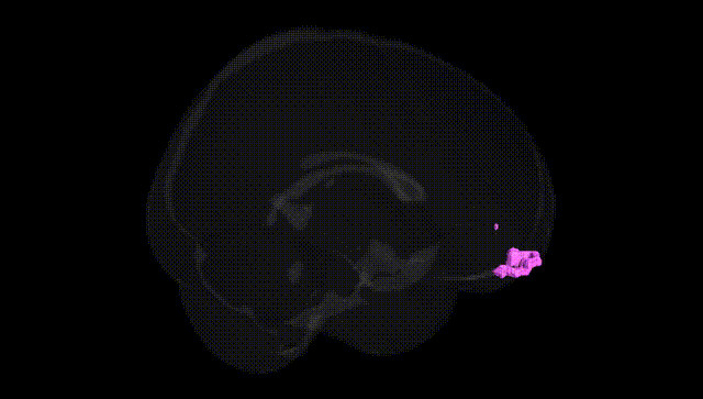 Full Brain Black