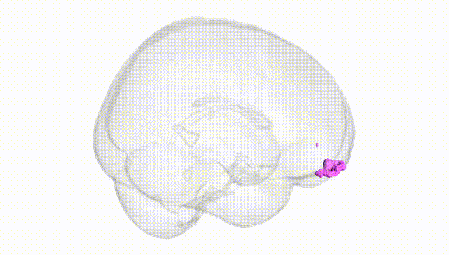 Full Brain White