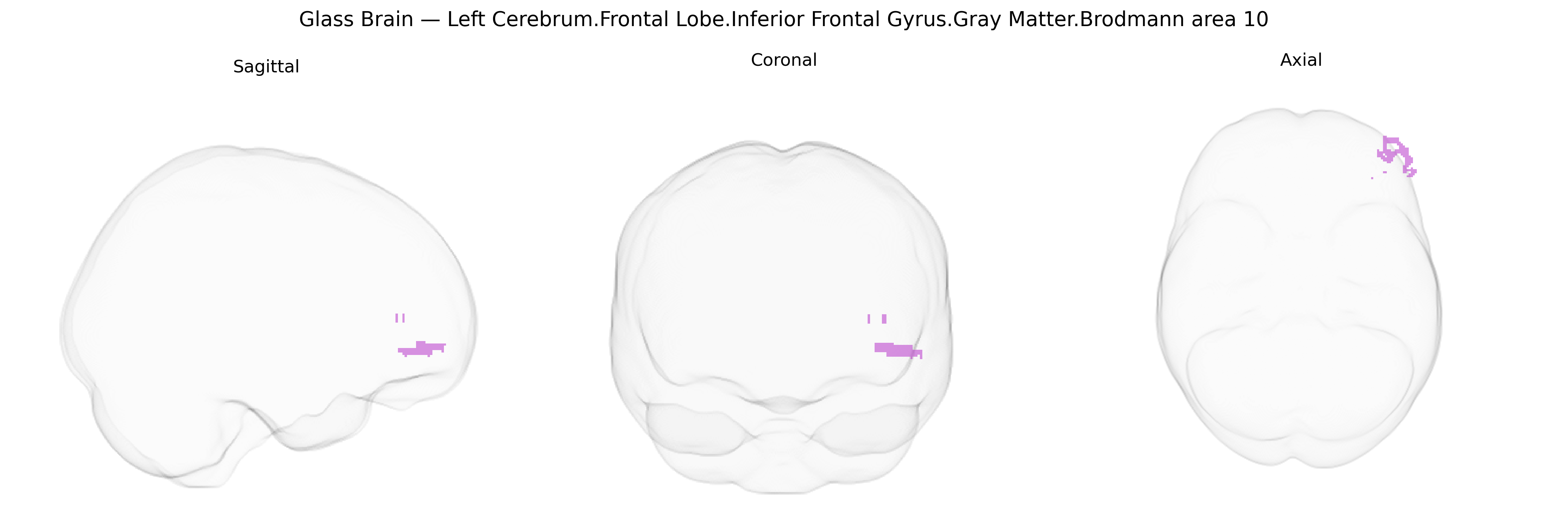 Triplanar Ghost Brain
