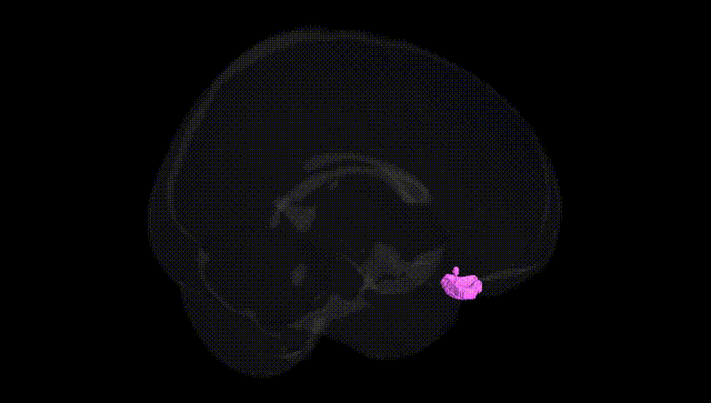 Full Brain Black