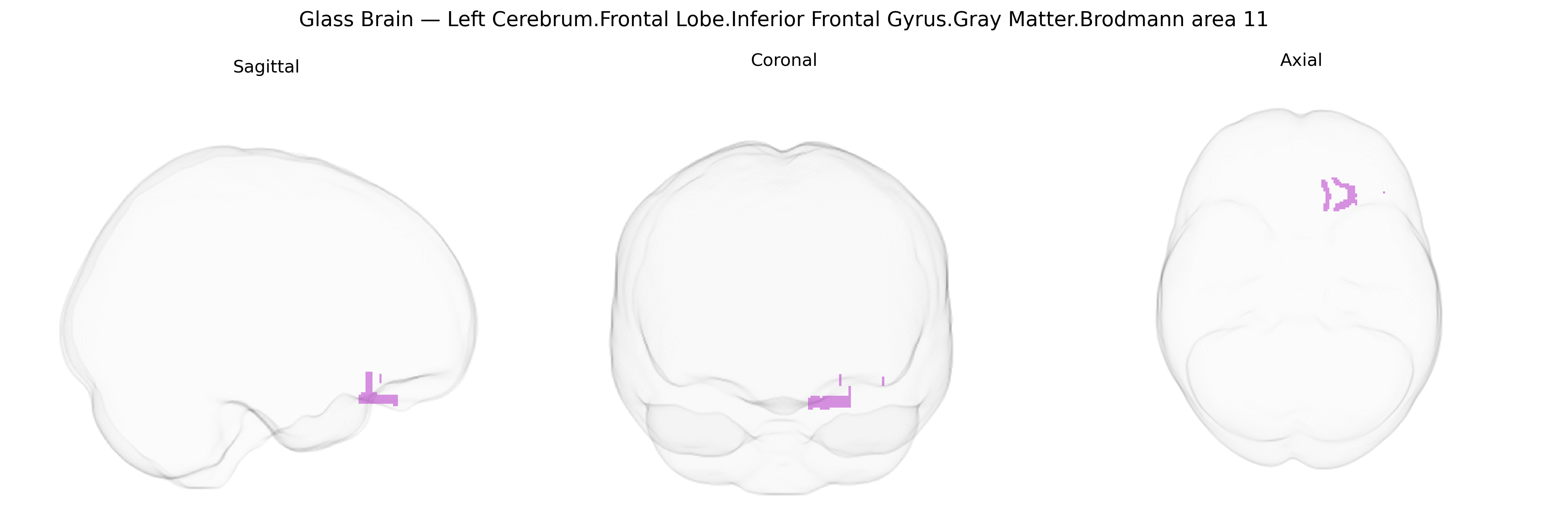 Triplanar Ghost Brain