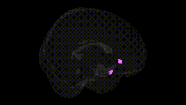 Full Brain Black