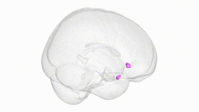 Full Brain White