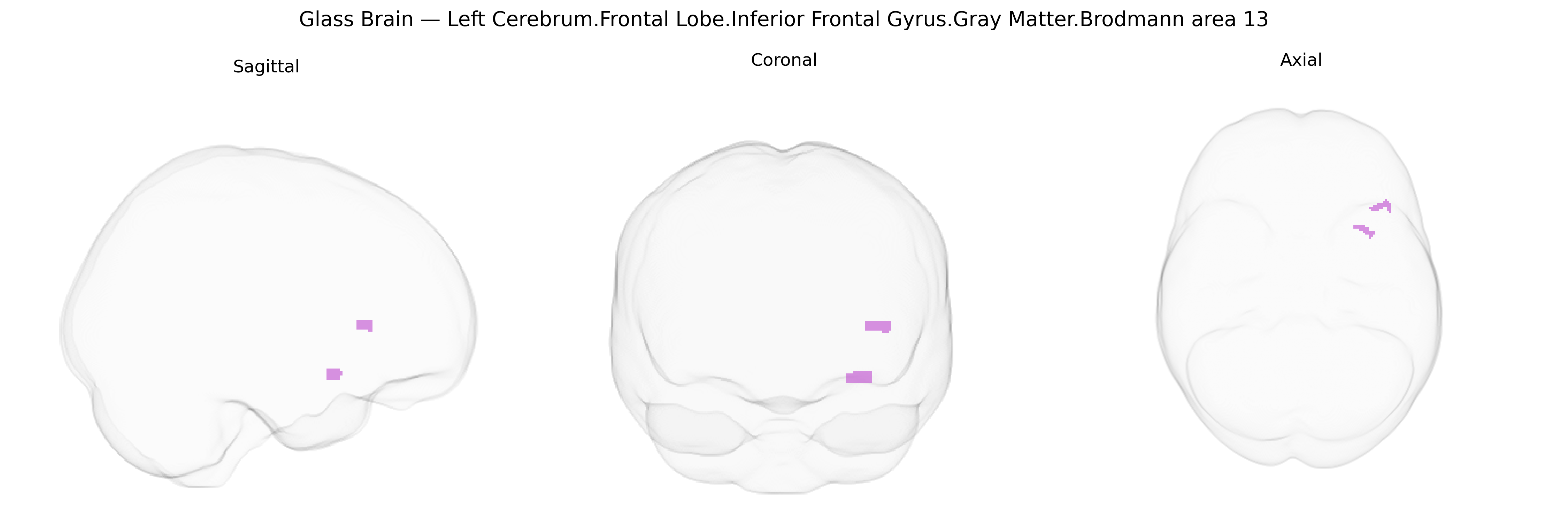 Triplanar Ghost Brain