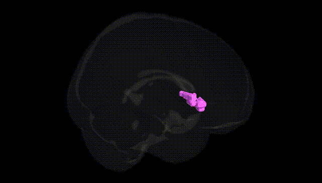 Full Brain Black