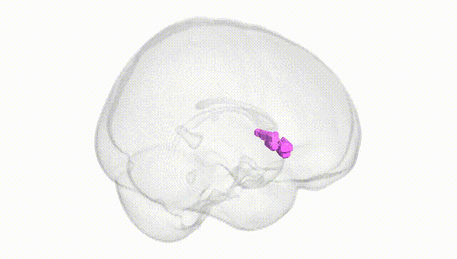 Full Brain White