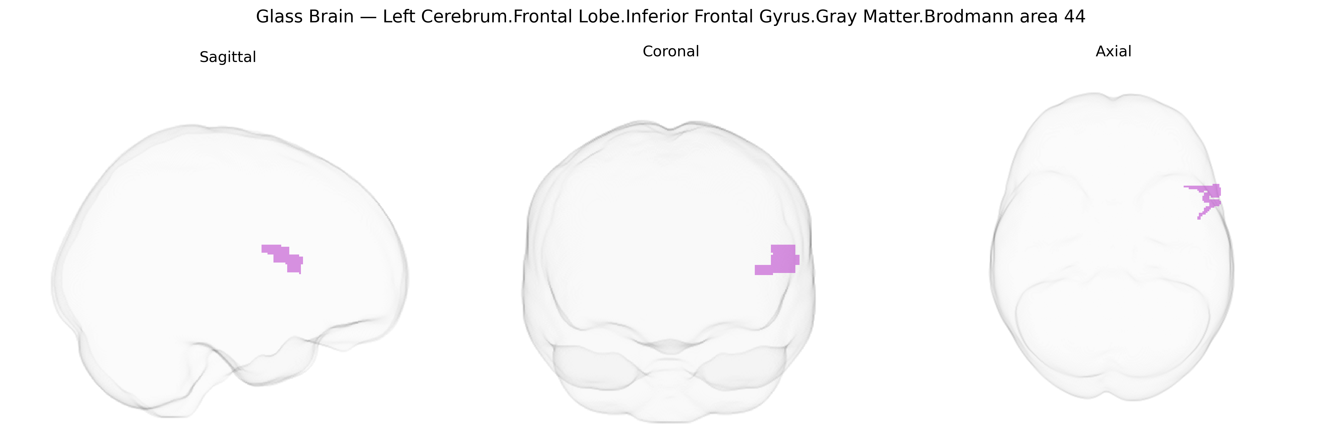 Triplanar Ghost Brain