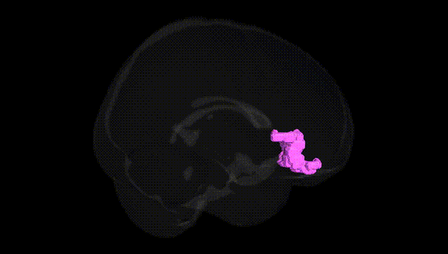 Full Brain Black