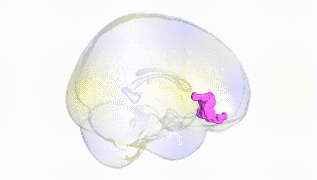 Full Brain White