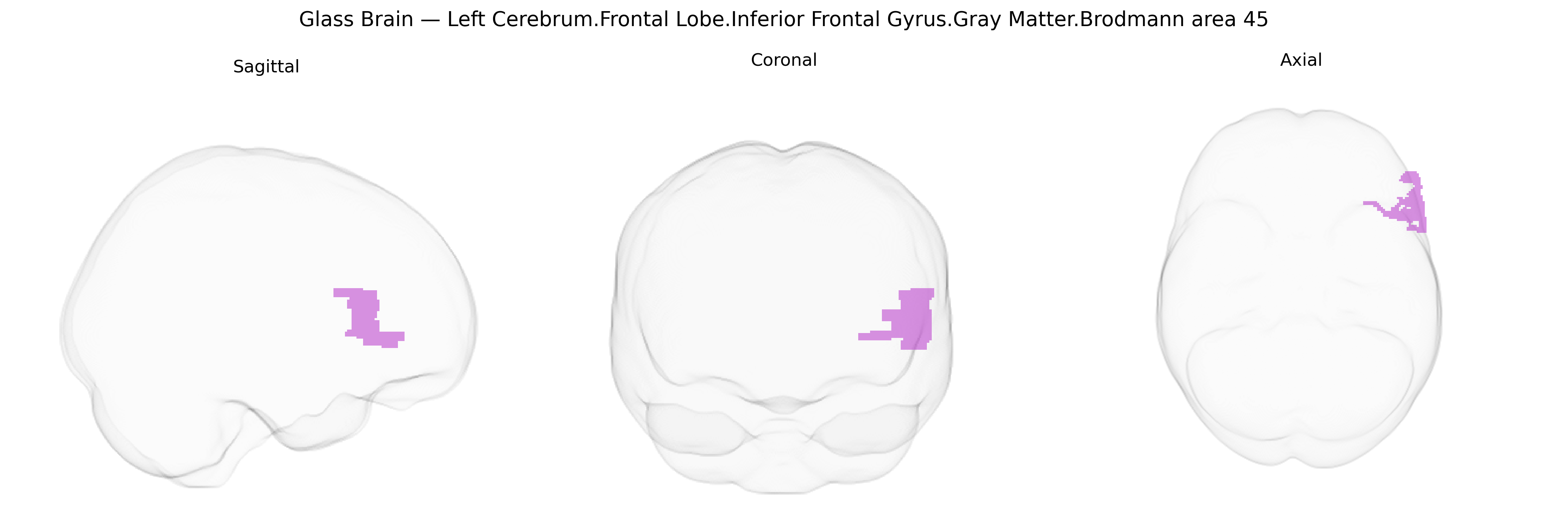 Triplanar Ghost Brain
