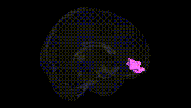 Full Brain Black