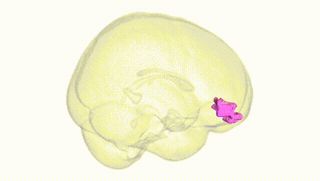 Full Brain White