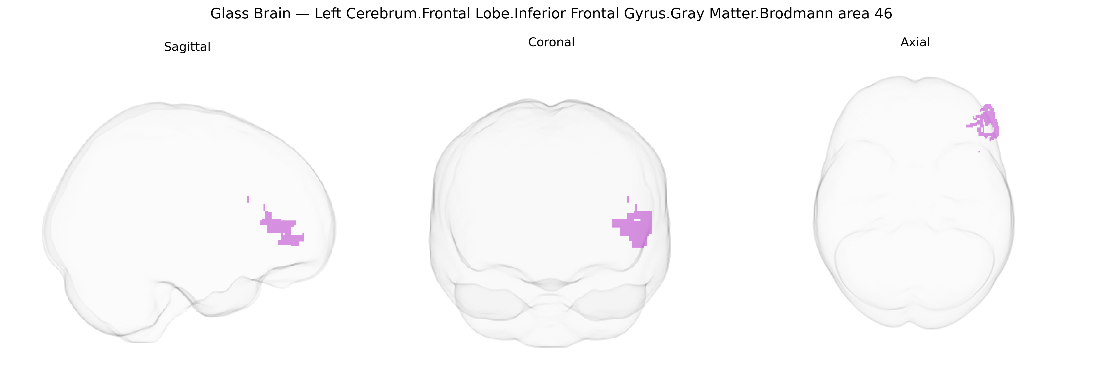 Triplanar Ghost Brain