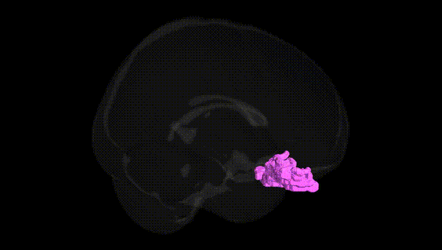 Full Brain Black