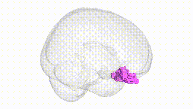Full Brain White