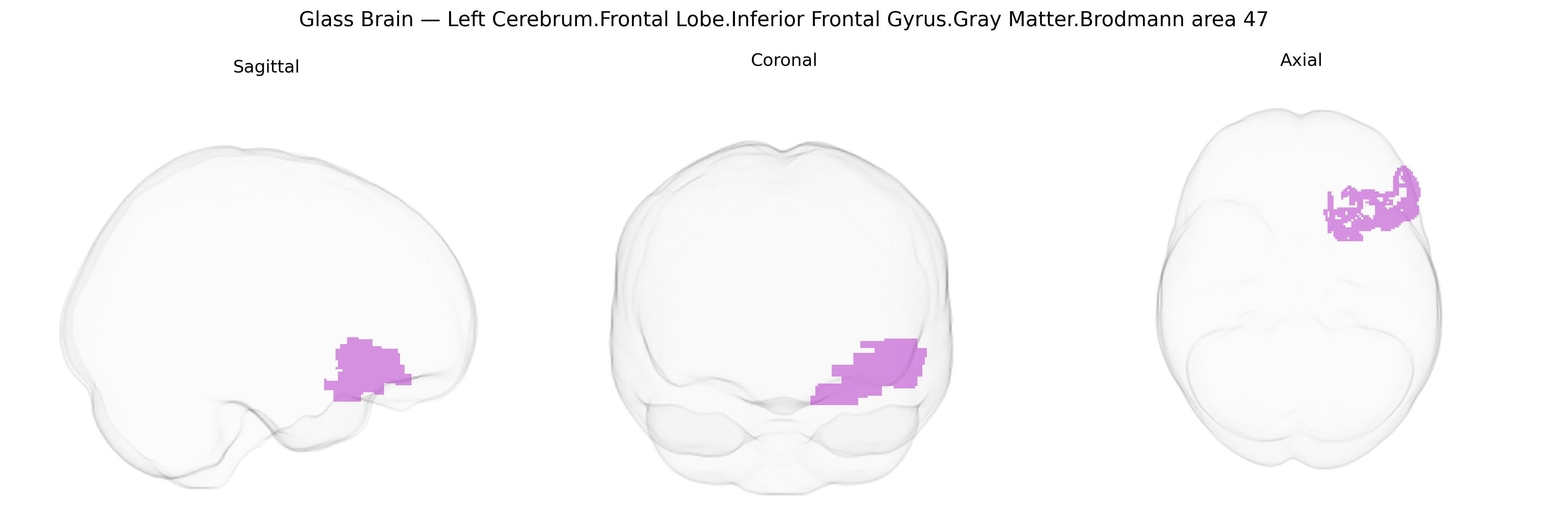 Triplanar Ghost Brain