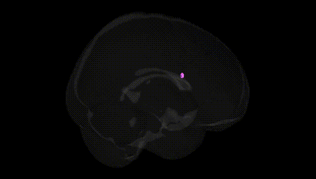 Full Brain Black