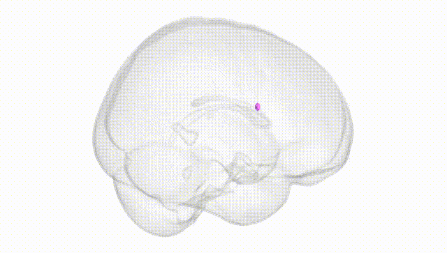 Full Brain White