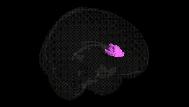 Full Brain Black