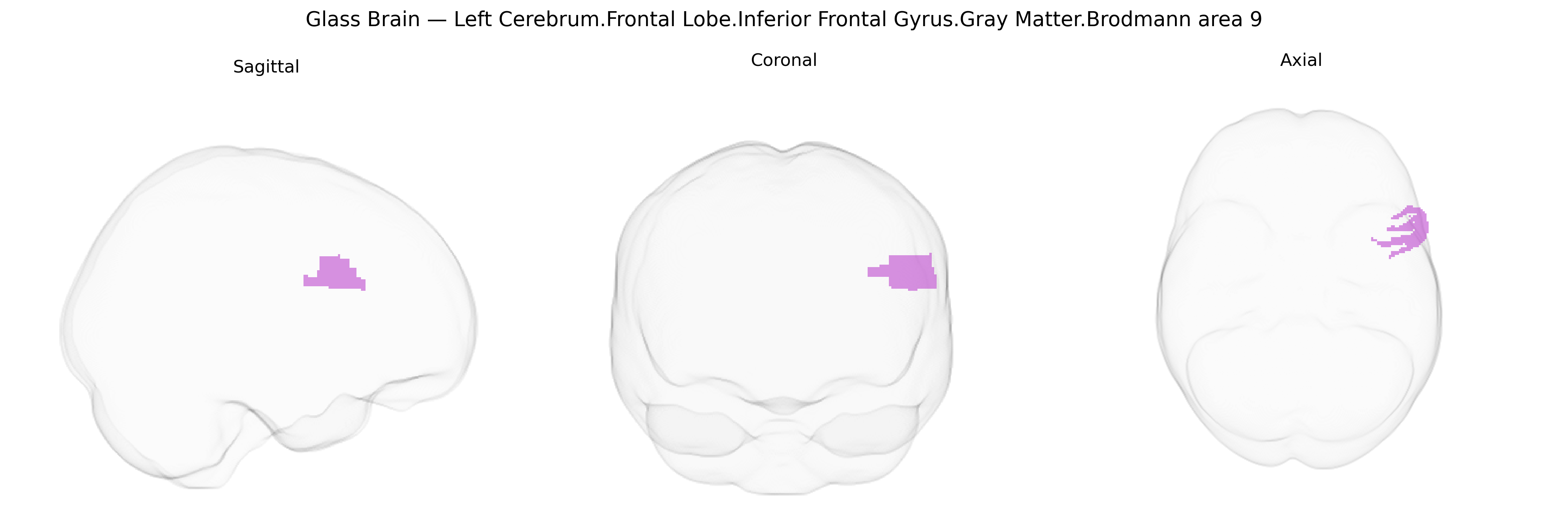 Triplanar Ghost Brain