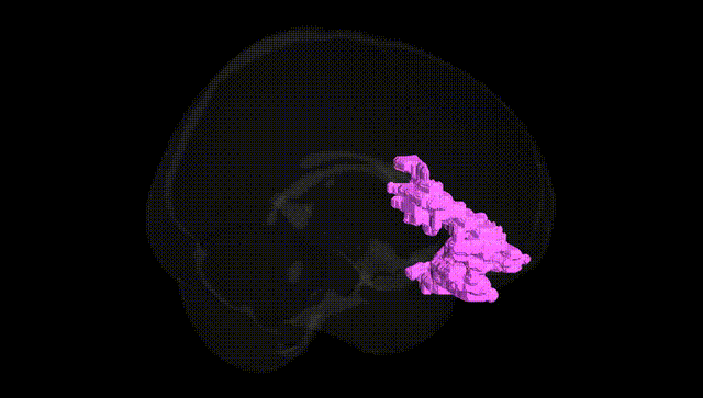 Full Brain Black