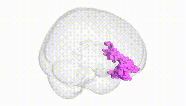 Full Brain White