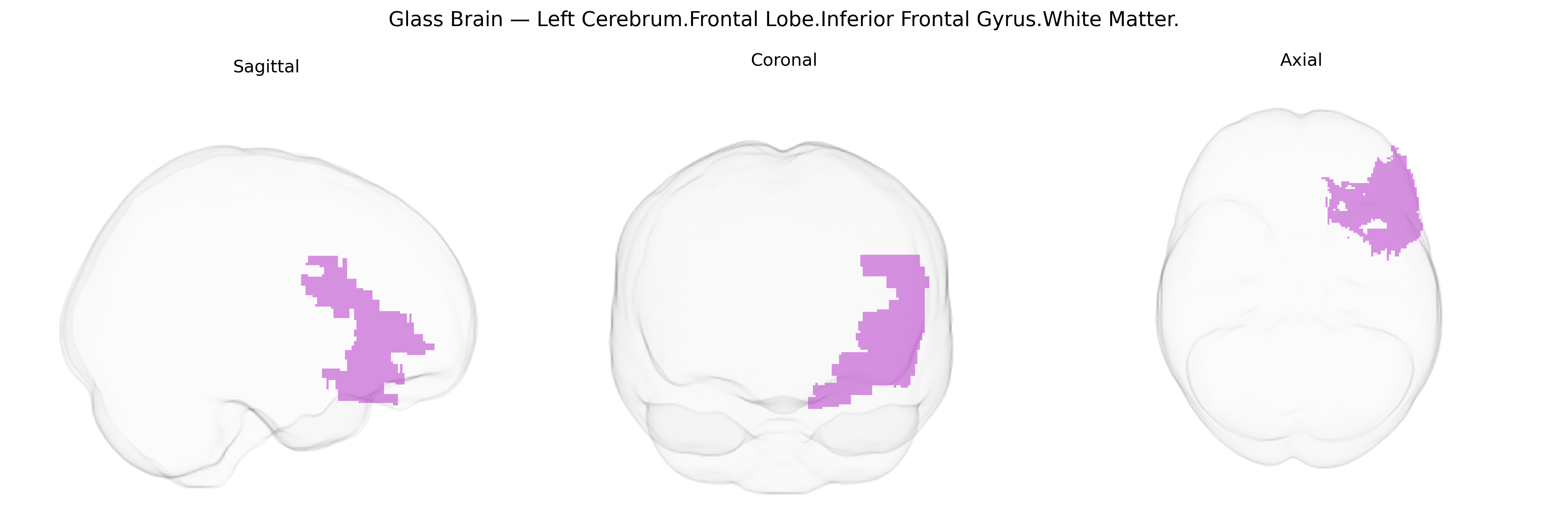 Triplanar Ghost Brain
