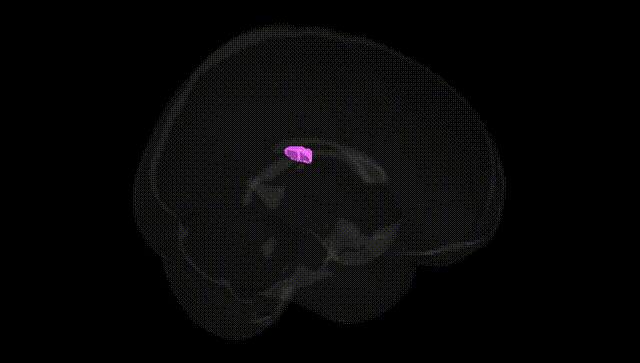 Full Brain Black