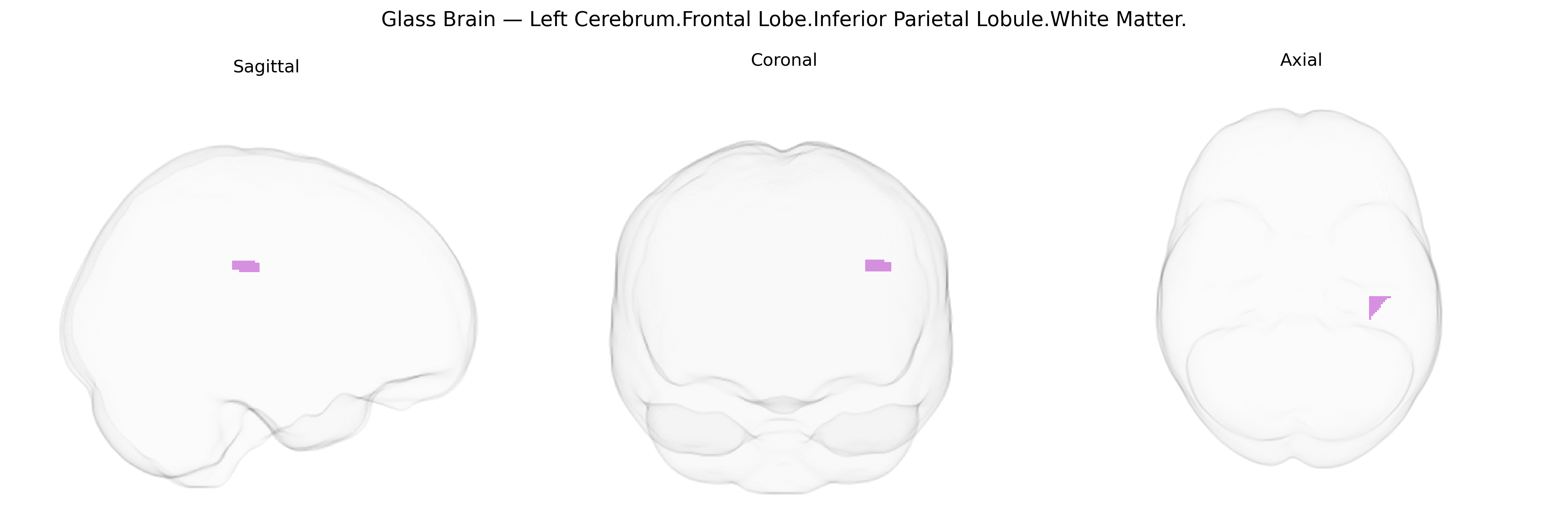Triplanar Ghost Brain