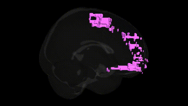 Full Brain Black