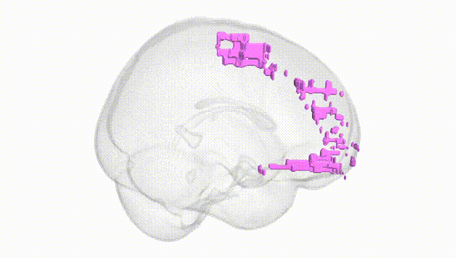 Full Brain White