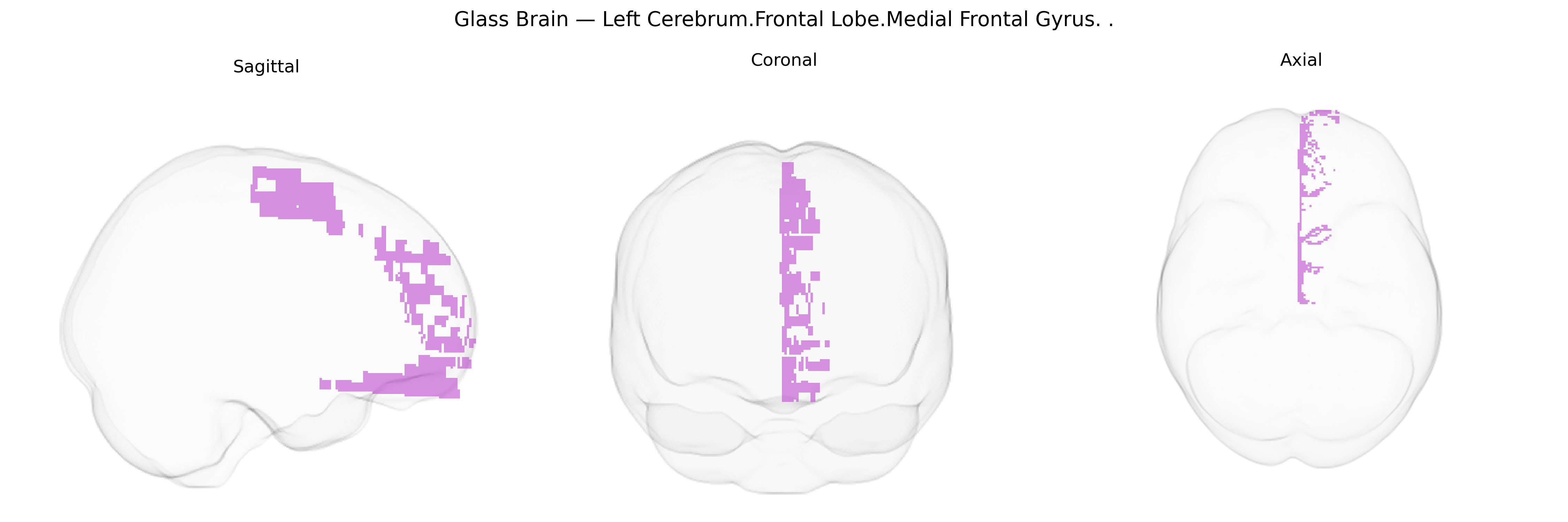 Triplanar Ghost Brain