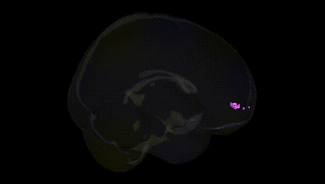 Full Brain Black